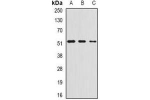 Western blot analysis of AMCase expression in HepG2 (A), mouse stomach (B), rat lung (C) whole cell lysates. (CHIA anticorps)