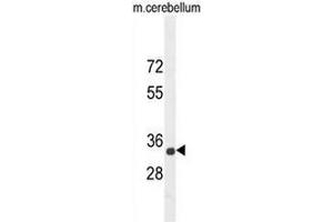 CADM1 Antibody (N-term) western blot analysis in mouse cerebellum tissue lysates (35µg/lane). (CADM1 anticorps  (N-Term))