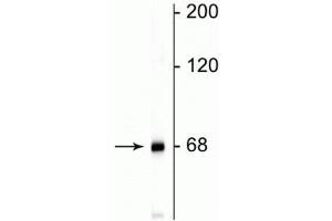 Western blot of rat cortical lysate showing specific immunolabeling of the ~68 kDa NF-L protein. (NEFL anticorps)