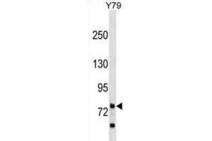 Western Blotting (WB) image for anti-Rhophilin, rho GTPase Binding Protein 1 (RHPN1) antibody (ABIN3000053) (RHPN1 anticorps)