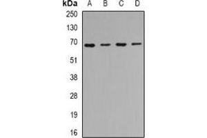 Western blot analysis of CIP4 expression in Hela (A), SKOV3 (B), mouse kidney (C), mouse heart (D) whole cell lysates. (TRIP10 anticorps)