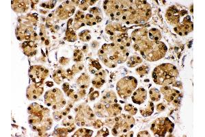 Immunohistochemistry (Paraffin-embedded Sections) (IHC (p)) image for anti-Parkinson Protein 7 (PARK7) (AA 2-189) antibody (ABIN3043589)