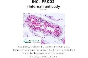 Image no. 1 for anti-Protein Kinase D2 (PKD2) (Internal Region) antibody (ABIN1738346) (PKD2 anticorps  (Internal Region))