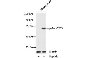 Western blot analysis of extracts from mouse brain tissue, using phospho-Tau-T205 antibody (ABIN3019697, ABIN3019698, ABIN3019699 and ABIN7101862).