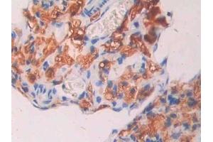 Detection of CA7 in Mouse Ovary Tissue using Polyclonal Antibody to Carbonic Anhydrase VII (CA7)