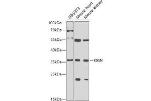 Western blot analysis of extracts of various cell lines, using OGN antibody (ABIN6131952, ABIN6145008, ABIN6145009 and ABIN6222384) at 1:1000 dilution. (OGN anticorps  (AA 20-298))