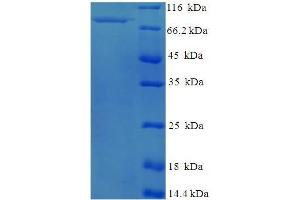 SDS-PAGE (SDS) image for Plasminogen Activator, Tissue (PLAT) (AA 36-556), (partial) protein (His-SUMO Tag) (ABIN5710111)