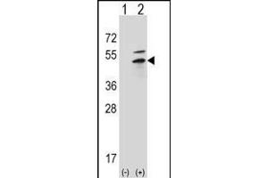 Western blot analysis of PRKAR2B (arrow) using rabbit polyclonal PRKAR2B Antibody (G46) (ABIN391062 and ABIN2841217).