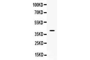 Western blot analysis of CD48 expression in CEM whole cell lysates ( Lane 1). (CD48 anticorps  (AA 51-146))