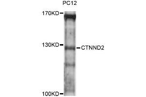 Western blot analysis of extracts of PC-12 cells, using CTNND2 antibody (ABIN6293310) at 1:3000 dilution. (CTNND2 anticorps)