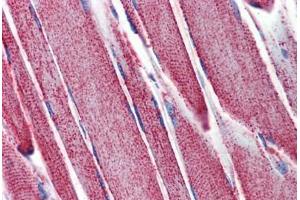 Skeletal muscle, Human: Formalin-Fixed, Paraffin-Embedded (FFPE)