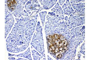 IHC analysis of IL17 using anti-IL17 antibody .