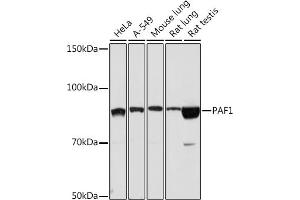 Western blot analysis of extracts of various cell lines, using P Rabbit mAb (ABIN7269152) at 1:1000 dilution. (PAF1/PD2 anticorps)