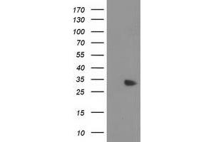 Western Blotting (WB) image for anti-Myeloid Differentiation Primary Response Gene (88) (MYD88) antibody (ABIN1499612)