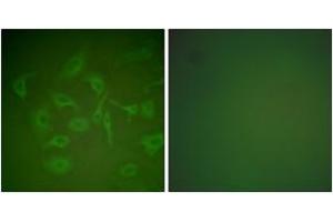 Immunofluorescence analysis of HepG2 cells, using Mammaglobin Antibody. (Mammaglobin anticorps  (AA 41-90))