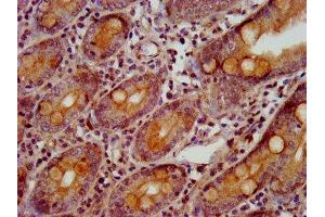 IHC image of ABIN7154777 diluted at 1:800 and staining in paraffin-embedded human small intestine tissue performed on a Leica BondTM system.