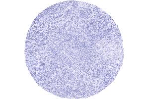 PAX8 staining is completely absent in lymphocytes lymph node