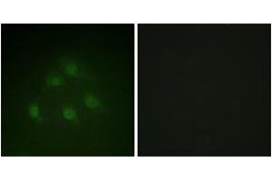 Immunofluorescence analysis of HeLa cells, using Smad1 (Ab-187) Antibody.