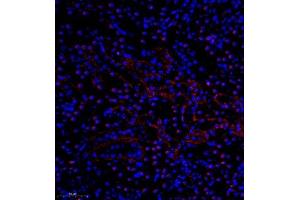 Immunofluorescence of paraffin embedded mouse nephritis using pax2 (ABIN7074974) at dilution of 1:600 (300x lens)