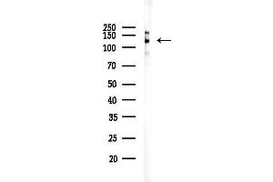 Western blot analysis of lysates from COLO205 cells(heat-shock treatment), using Phospho-JAK2 (Tyr570) Antibody at 1/1000 dilution.