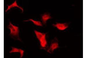 ABIN6267648 staining HuvEc by IF/ICC.