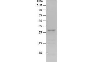 Western Blotting (WB) image for Glucagon (GCG) (AA 53-89) protein (His-IF2DI Tag) (ABIN7124289)