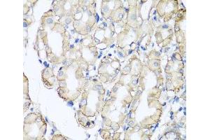 Immunohistochemistry of paraffin-embedded Human stomach using AHCYL1 Polyclonal Antibody at dilution of 1:100 (40x lens).