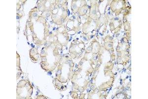 Immunohistochemistry of paraffin-embedded Human stomach using AHCYL1 Polyclonal Antibody at dilution of 1:100 (40x lens). (AHCYL1 anticorps)