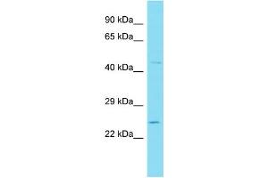 Host: Rabbit Target Name: WFDC3 Sample Type: 721_B Whole Cell lysates Antibody Dilution: 1. (WFDC3 anticorps  (N-Term))