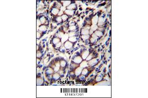 IQCA1 Antibody immunohistochemistry analysis in formalin fixed and paraffin embedded human rectum tissue followed by peroxidase conjugation of the secondary antibody and DAB staining. (IQCA1 anticorps  (C-Term))