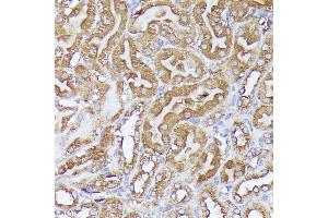 Immunohistochemistry of paraffin-embedded mouse kidney using DLAT antibody (ABIN7266768) at dilution of 1:100 (40x lens).