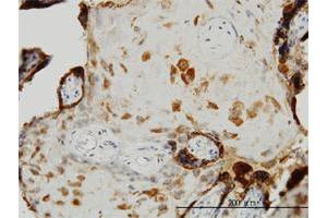 Immunoperoxidase of monoclonal antibody to TIMP2 on formalin-fixed paraffin-embedded human placenta. (TIMP2 anticorps  (AA 27-220))