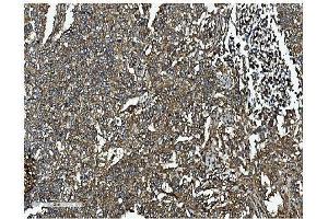 IHC analysis of Clathrin heavy chain/CLTC using anti-Clathrin heavy chain/CLTC antibody (ABIN7602704). (Clathrin Heavy Chain (CLTC) (AA 967-1668) anticorps)