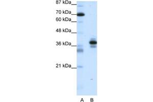 Western Blotting (WB) image for anti-Paired-Like Homeodomain 1 (PITX1) antibody (ABIN2461668) (PITX1 anticorps)