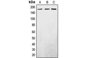 Western blot analysis of EGFR expression in DLD (A), SP2/0 (B), PC12 (C) whole cell lysates. (EGFR anticorps  (C-Term))