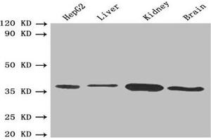 Western blot All lanes: BDH1 antibody at 2. (BDH1 anticorps  (AA 47-343))
