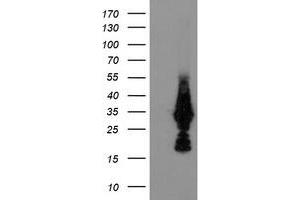 Western Blotting (WB) image for anti-Methylmalonic Aciduria (Cobalamin Deficiency) CblC Type, with Homocystinuria (MMACHC) antibody (ABIN1499513) (MMACHC anticorps)