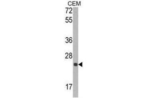 Western blot analysis of TIMP1 Antibody (N-term) in CEM cell line lysates (35ug/lane). (TIMP1 anticorps  (N-Term))