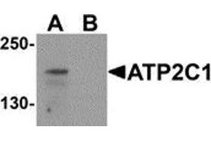 Western blot analysis of ATP2C1 in mouse brain tissue lysate with ATP2C1 antibody at 1 μg/ml in (A) the absence and (B) the presence of blocking peptide