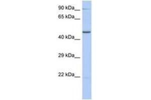 ZNF669 anticorps  (AA 107-156)