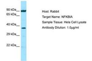 Image no. 1 for anti-Nuclear Factor of kappa Light Polypeptide Gene Enhancer in B-Cells Inhibitor, alpha (NFKBIA) (N-Term) antibody (ABIN6749808)