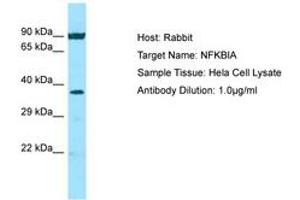 Image no. 1 for anti-Nuclear Factor of kappa Light Polypeptide Gene Enhancer in B-Cells Inhibitor, alpha (NFKBIA) (N-Term) antibody (ABIN6749808) (NFKBIA anticorps  (N-Term))