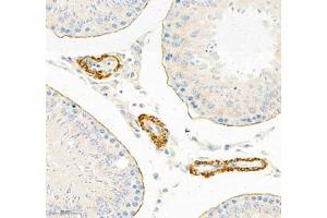Immunohistochemistry of paraffin embedded rat testis using Desmuslin (ABIN7075800) at dilution of 1:500 (250x lens) (SYNM anticorps)