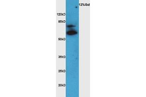 Lane 1: rat brain lysates probed with Rabbit Anti-VAT Polyclonal Antibody, Unconjugated (ABIN735113) at 1:300 overnight at 4 °C.
