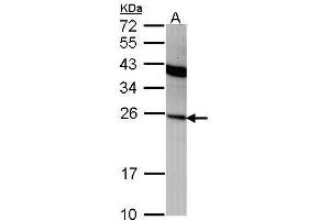 IFNA2 anticorps  (C-Term)