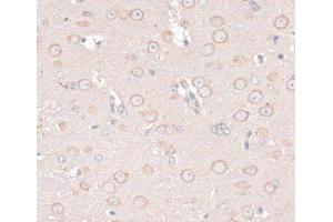 Immunohistochemistry of paraffin-embedded Mouse brain using ABCF2 Polyclonal Antibody at dilution of 1:100 (40x lens). (ABCF2 anticorps)
