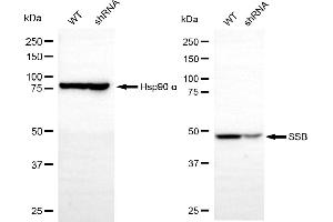 Western blotting analysis using SSB antibody (ABIN7800357). (SSB anticorps)