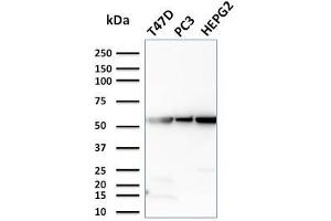 Western Blot Analysis of T47D, PC3, HePG2 cell lysates using GPI Mouse Monoclonal Antibody (CPTC-GPI-1). (GPI anticorps)