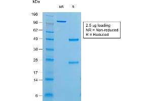 SDS-PAGE Analysis of Purified Thyroglobulin Mouse Recombinant Monoclonal Antibody (r6E1). (Recombinant Thyroglobulin anticorps)