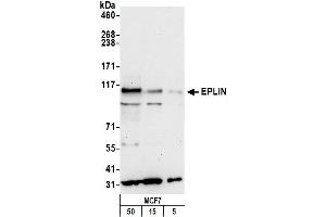 anti-LIM Domain and Actin Binding 1 (LIMA1) (C-Term) antibody